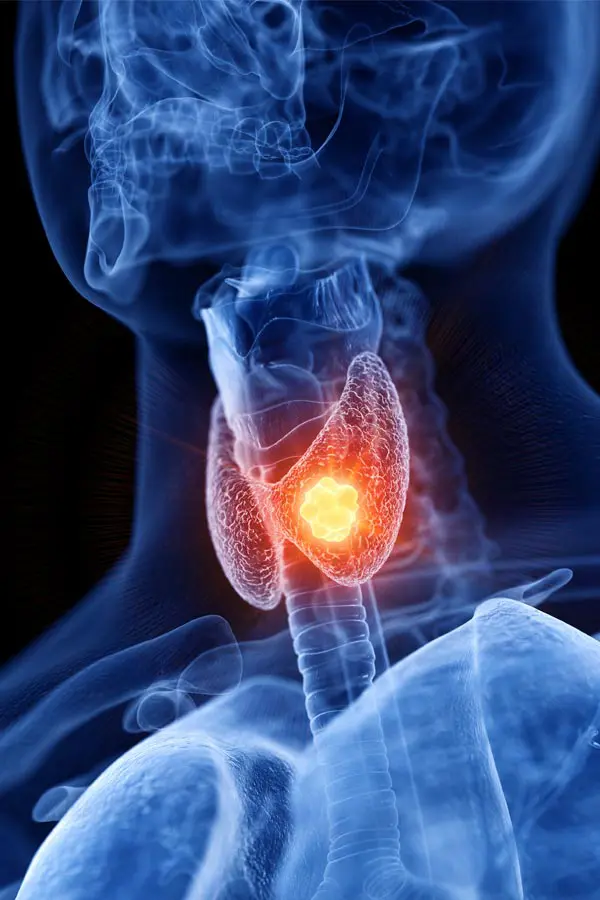 Thyroid-Imbalance-Treatment A 3D illustration of an x-ray of a human neck, highlighting the thyroid. Get help with thyroid imbalance from Lux Hormones & Health Wellness in San Diego.